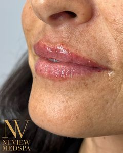 Nuview Medspa photo 13