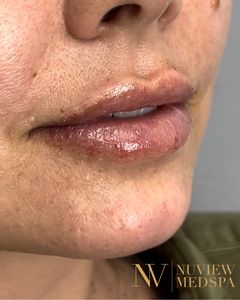 Nuview Medspa photo 14