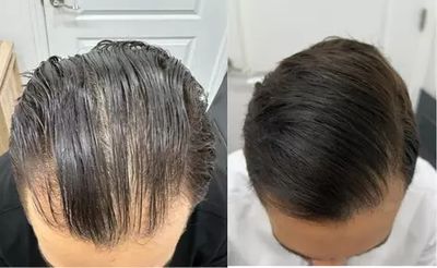 REJUVA Dermatology, Cosmetic & Weight Loss Center photo 10