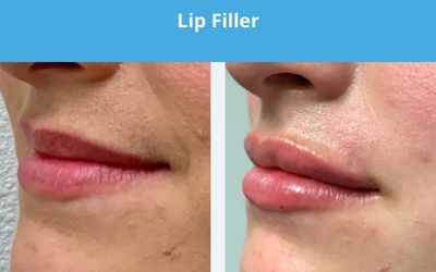 REJUVA Dermatology, Cosmetic & Weight Loss Center photo 23