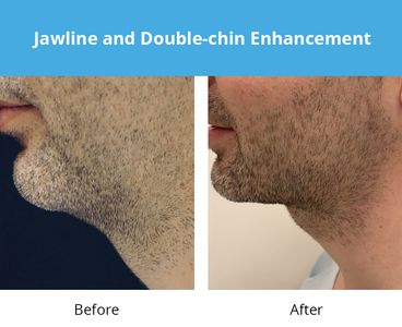 REJUVA Dermatology, Cosmetic & Weight Loss Center photo 24