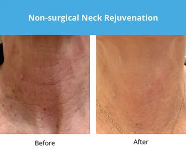 REJUVA Dermatology, Cosmetic & Weight Loss Center photo 26