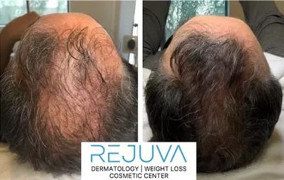 REJUVA Dermatology, Cosmetic & Weight Loss Center photo 27