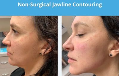 REJUVA Dermatology, Cosmetic & Weight Loss Center photo 28