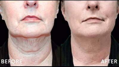 REJUVA Dermatology, Cosmetic & Weight Loss Center photo 30