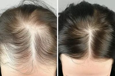 REJUVA Dermatology, Cosmetic & Weight Loss Center photo 31