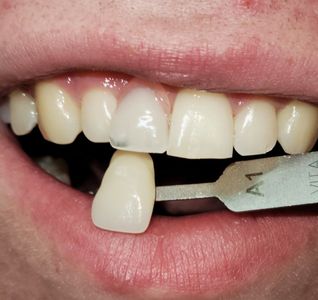 Florida Dental Centers of Bradenton photo 4