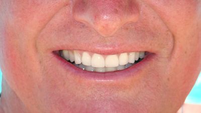 Advanced Dental Cosmetic Center P.A. photo 26