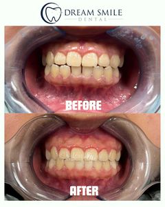 Dream Smile Dental photo 17