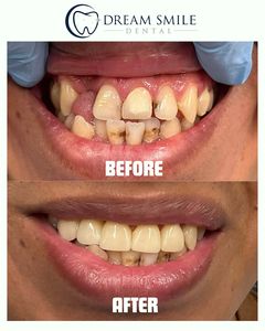 Dream Smile Dental photo 18