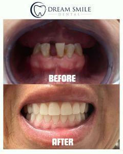 Dream Smile Dental photo 19