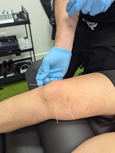 NovaSpine Chiropractic Near Me Venice photo 19