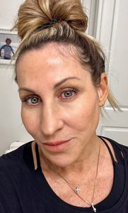 Elite Medical Spa of Parrish photo 28