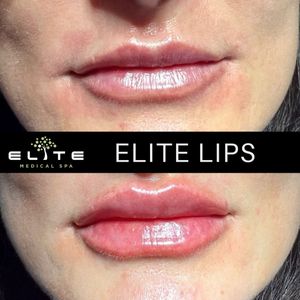 Elite Medical Spa of Parrish photo 35