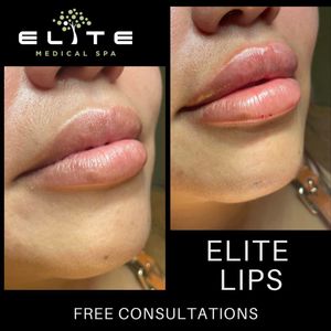 Elite Medical Spa of Parrish photo 37