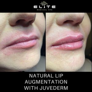 Elite Medical Spa of Parrish photo 38