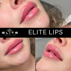 Elite Medical Spa of Parrish photo 39