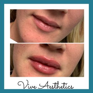 Vive Aesthetics photo 18