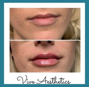 Vive Aesthetics photo 19