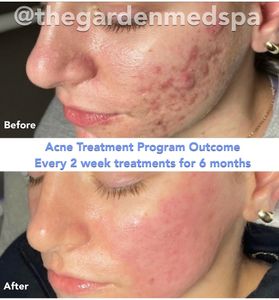 The Garden Medical Spa, Wellness & Massage photo 33