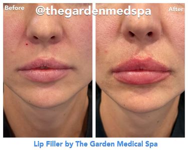 The Garden Medical Spa, Wellness & Massage photo 40