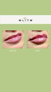 Elite Medical Spa of Sarasota photo 3