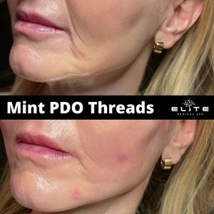 Elite Medical Spa of Sarasota photo 17