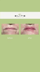 Elite Medical Spa of Sarasota photo 21