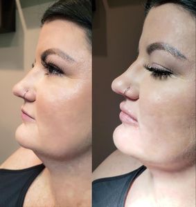 Elite Medical Spa of Sarasota photo 30