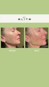 Elite Medical Spa of Sarasota photo 39