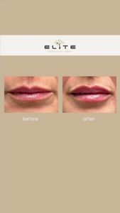 Elite Medical Spa of Sarasota photo 41