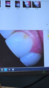 Expressions Cosmetic and Family Dentistry photo 10