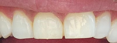 Expressions Cosmetic and Family Dentistry photo 11