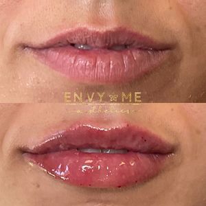 Envy Me Aesthetics photo 2