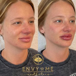 Envy Me Aesthetics photo 7