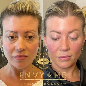 Envy Me Aesthetics photo 9