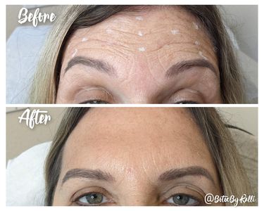 Envy Me Aesthetics photo 10