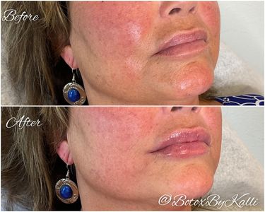 Envy Me Aesthetics photo 11