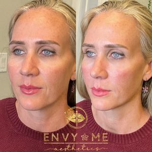 Envy Me Aesthetics photo 12