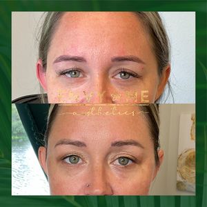 Envy Me Aesthetics photo 13