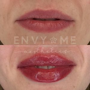Envy Me Aesthetics photo 16
