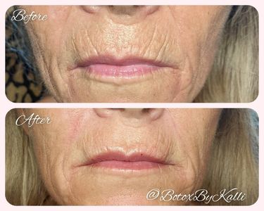 Envy Me Aesthetics photo 17