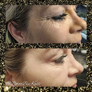 Envy Me Aesthetics photo 18