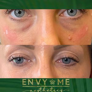 Envy Me Aesthetics photo 20