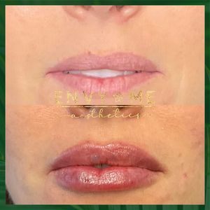 Envy Me Aesthetics photo 21