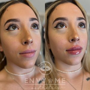 Envy Me Aesthetics photo 23