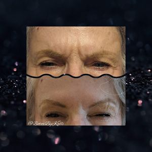 Envy Me Aesthetics photo 28