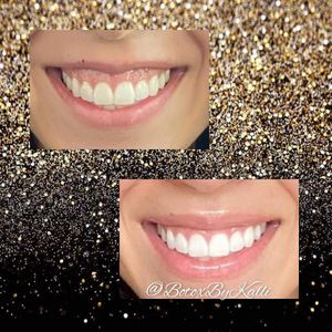 Envy Me Aesthetics photo 29