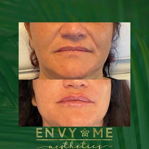 Envy Me Aesthetics photo 31