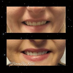 Envy Me Aesthetics photo 32